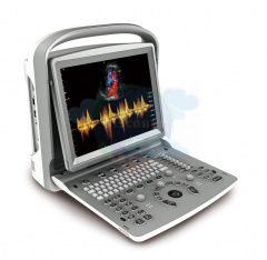 УЗИ аппарат CHISON SonoTouch 50 (ECO 6)